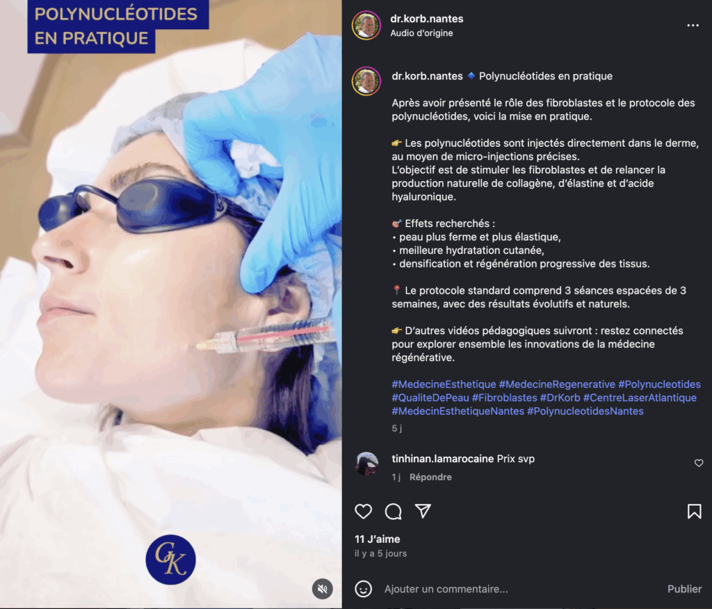 polynucléotides injections vidéo